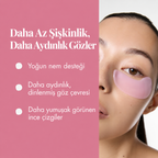 Göz Altı Yenileme Bantları